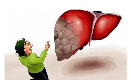 頭部出現(xiàn)這4種狀況，就要注意你的肝了！